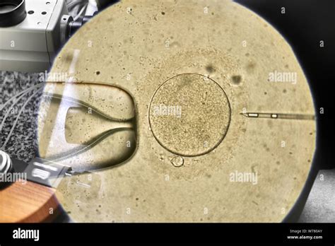 Amazing process of the in vitro fertilization of a female egg through ...