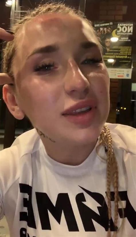 Dumna Marta Linkiewicz Pokaza A Twarz Po Walce Z Sex Masterk Nigdy Tak Zaje Cie Nie
