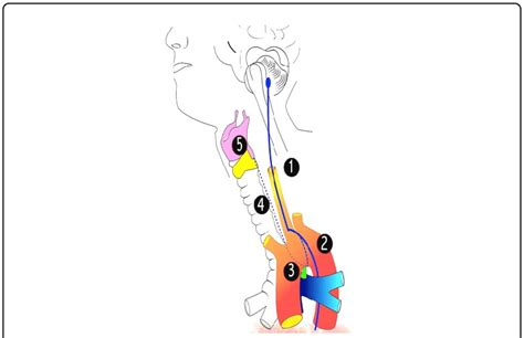 Anatomical zones of the left Recurrent Laryngeal Nerve. | Download ...