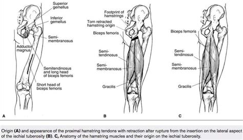 hamstring injuries  athletes sports medicine review