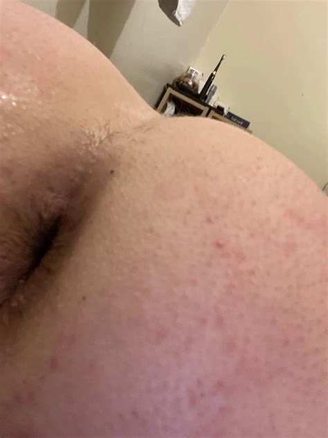 My Gaped Hole Nude Pics Xhamster