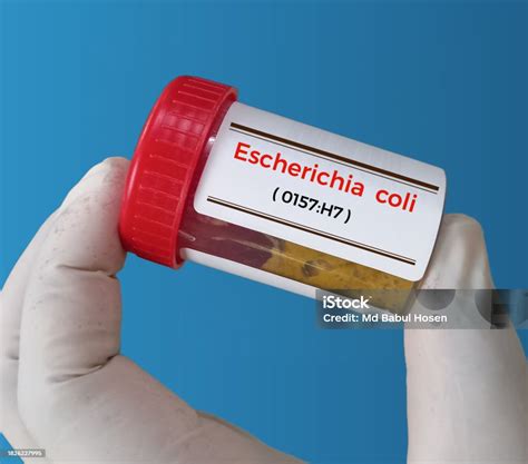 Muestra De Heces Para Prueba De Escherichia Coli O157h7 Serotipo De La