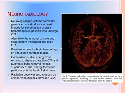 Dual Energy Ct