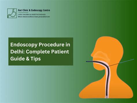 Endoscopy Procedure In Delhi Complete Patient Guide And Tips