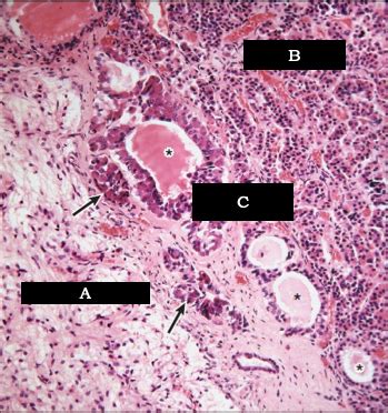 Anatomy 2 Histology Of The Endocrine System Flashcards Quizlet