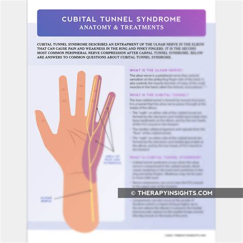 Cubital Tunnel Syndrome: Anatomy and Treatment – Adult and pediatric ...