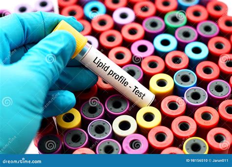 Lipid Profile Test Stock Photo Image Of Disease Hematology