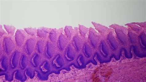 Human Tongue Under A Microscope Study Of Human Taste Buds Programming