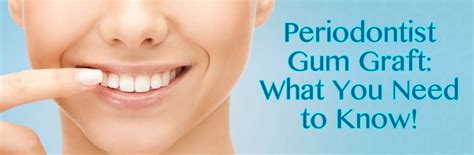 Periodontist Gum Graft In California What You Need To Know