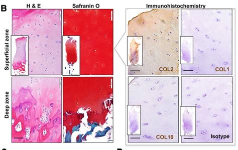 Chondrocyte Progenitors A New And Effective Cell Therapy For