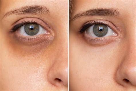 Which Ingredients Brighten Dark Circles Reviva Labs