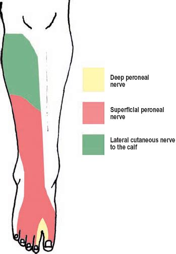 The Diagnostic Anatomy Of The Sciatic Nerve Neupsy Key