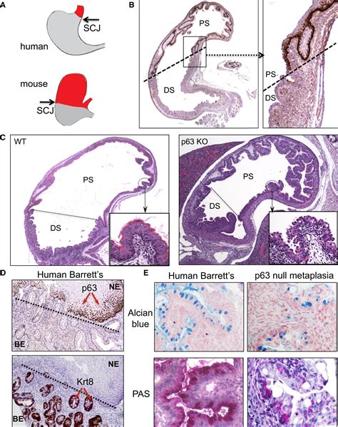 Residual Embryonic Cells as Precursors of a Barrett's-like Metaplasia: Cell