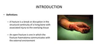 Principles of management of open fracture | PPT