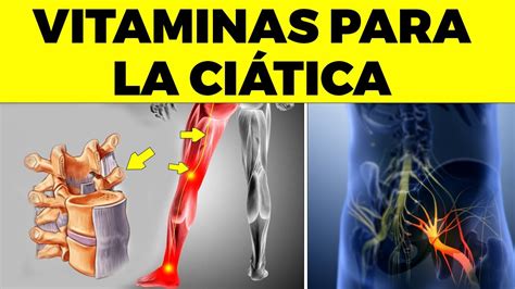 Vitaminas Obligatorias Para La Ci Tica O Dolor Del Nervio Ci Tico