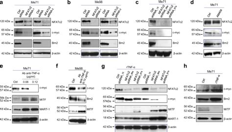 Correction to: NFATc2 is an intrinsic regulator of melanoma ... 