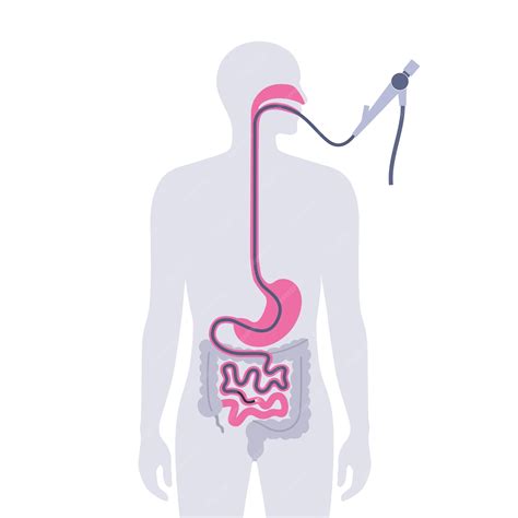 Premium Vector Esophagogastroduodenoscopy Medical Poster Diagnostic