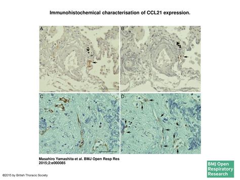 Immunohistochemical characterisation of CCL21 expression. - ppt download