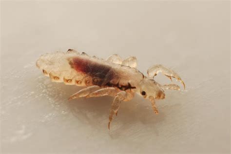 How Do Lice Survive? Lice Clinics of America - Portland, OR | Blog