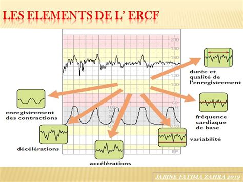 JABINE FATIMA ZAHRA Lenregistrement du rythme cardiaque fœtal ERCF