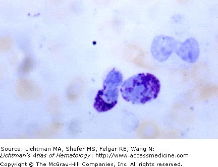 Toluidine Blue Stain Mast Cells And Basophils Oncohema Key