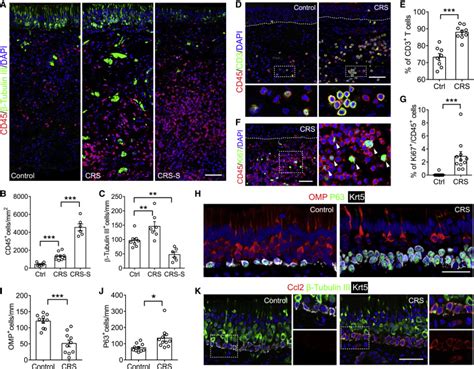 Chronic Inflammation Directs An Olfactory Stem Cell Functional Switch