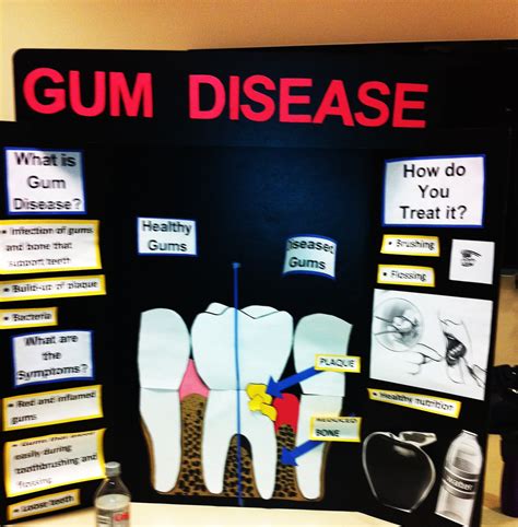My Perspective Of Dental Hygiene Blog Archive Table Clinic