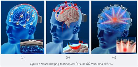 neural signals  lmages sawan