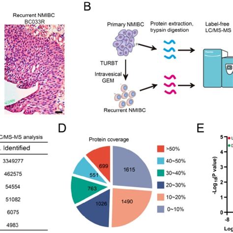 Label Free Proteomics Analysis Identifies Recurrence Related Proteomic