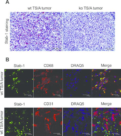 Stabilin Expression In Ts A Mouse Mammary Adenocarcinoma Tumor Wild