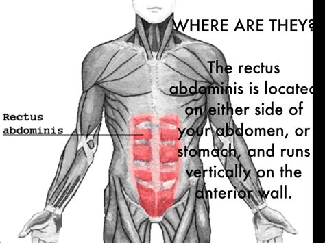 Rectus Abdominis Muscle Strain