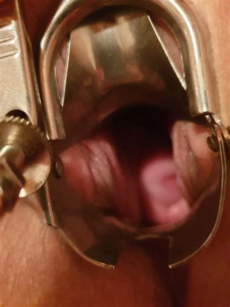 Pussy Und Klitoris 13 Nude Pics XHamster