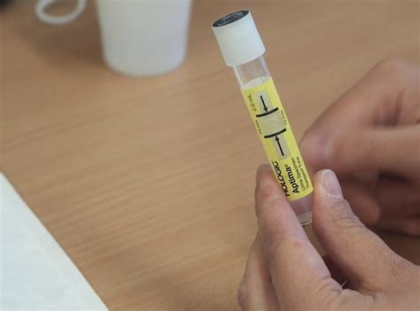 chlamydia test   benefits  healthy life vision