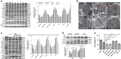 Hy Sdt Induced Macrophage Autophagy Occurs Earlier Than Apoptosis And