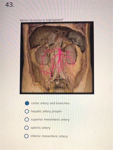 Solved Which Structure Is Highlighted Celiac Artery And Chegg