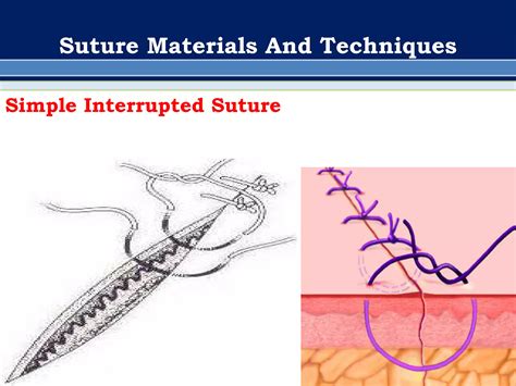 simple uninterrupted suture 8