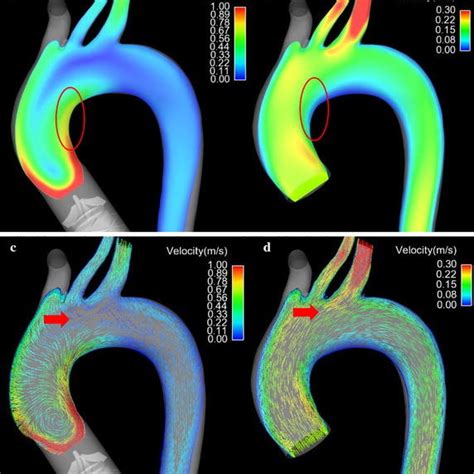 The Velocity Contour Curve And Vector Curve Of Blood Flow In The