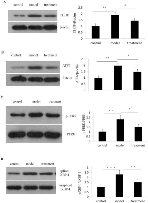 Ibutilide Treatment Attenuates Tunicamycin Induced Up Regulation Of