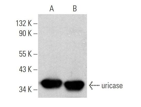 Uricase Antibody C 11 SCBT Santa Cruz Biotechnology