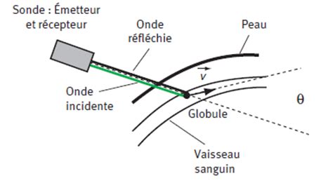 Application M Dicale De L Effet Doppler Ts