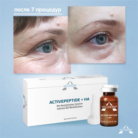 Veluderm - ACTIVEPEPTIDE + HA (стимулирование метаболизма кожи), 5 мл