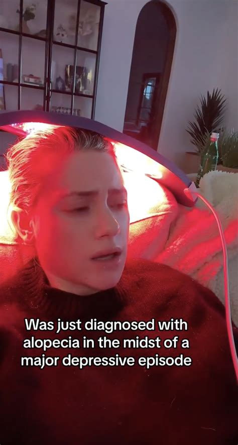 Lili Reinhart Reveals Alopecia Diagnosis After Suffering From ‘major Depressive Episode’ As She