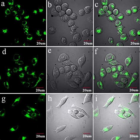 Figure S7. Confocal laser scanning microscope (CLSM) images of KB cells ...