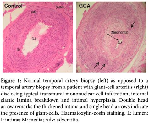 Neurovascular Medicine