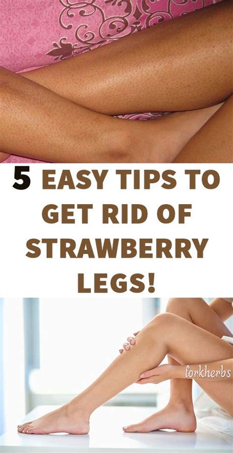 5 Easy Tips To Get Rid Of Strawberry Legs Strawberry Legs Exfoliate