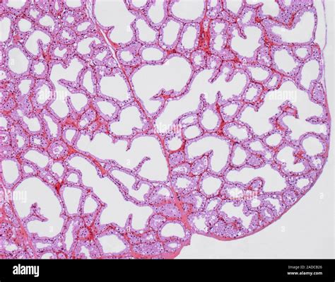 Lachrymal gland. Light micrograph of a section through the lachrymal ...