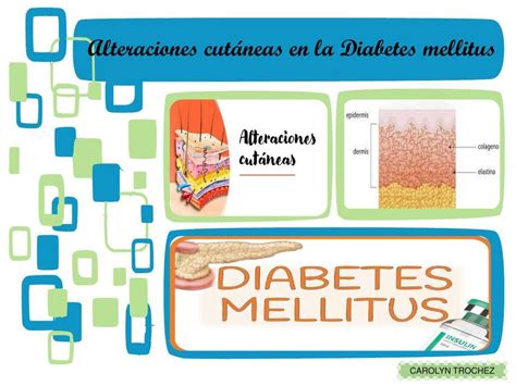 Alteraciones Cutáneas En La Diabetes Mellitus Carolyn Trochez Udocz