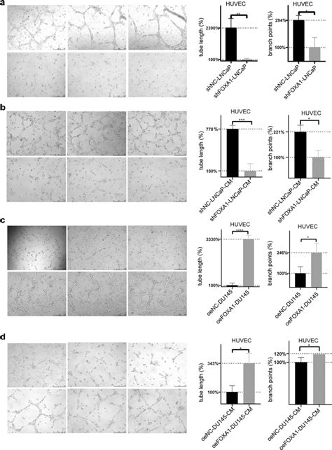 Foxa1 Expression In Prostate Cancer Cells Increased The Tube Forming