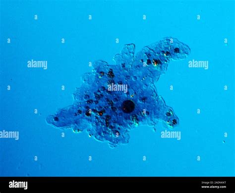 Amoeba Interference Contrast Light Micrograph Of The Large Protozoan