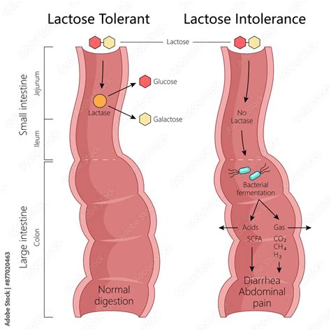 fenykepezes lactose tolerance  intolerance normal digestion